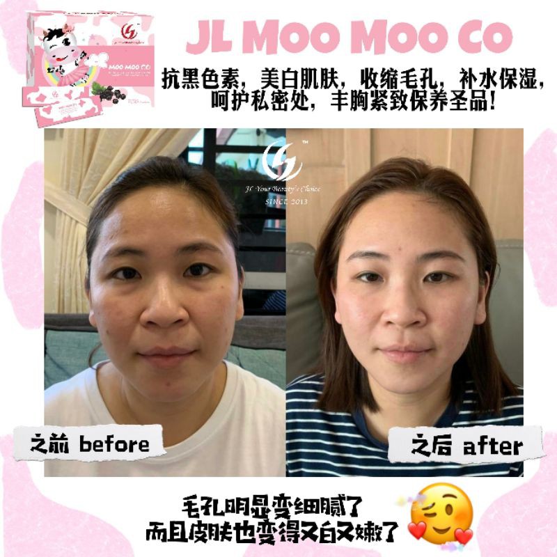 Jl Moo Moo Co 胶原蛋白肽1 Box 16 Packs Shopee Malaysia