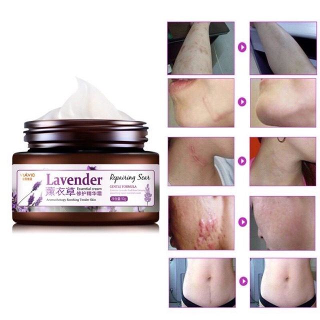 Lavender Cream Hilangkan Parut Lama Dan Baru Shopee Malaysia