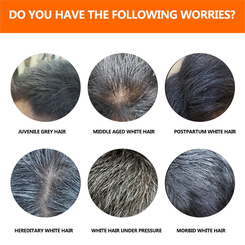 Herbal Natural White Hair Turns To Black Hair Treatment Shampoo Hair White  Hair Permanent Black Hair Care | Shopee Malaysia