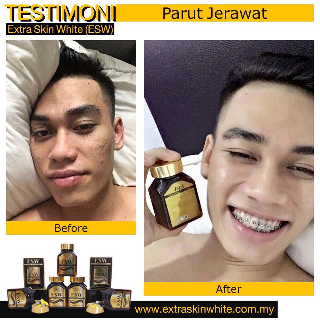 Buy Produk Pemutih Glutab Extra Skin White Kulit Putih Gebu Original Hq Seetracker Malaysia