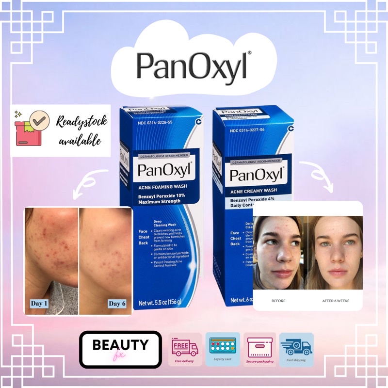 READY PanOxyl Acne Foaming Wash Benzoyl Peroxide 10 Maximum Strength