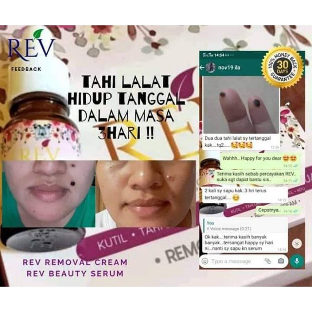 Rev Removal Cream Remove Wart Mole Cholesterol Seeds Ready Stock Free Gift Free Postage Shopee Malaysia