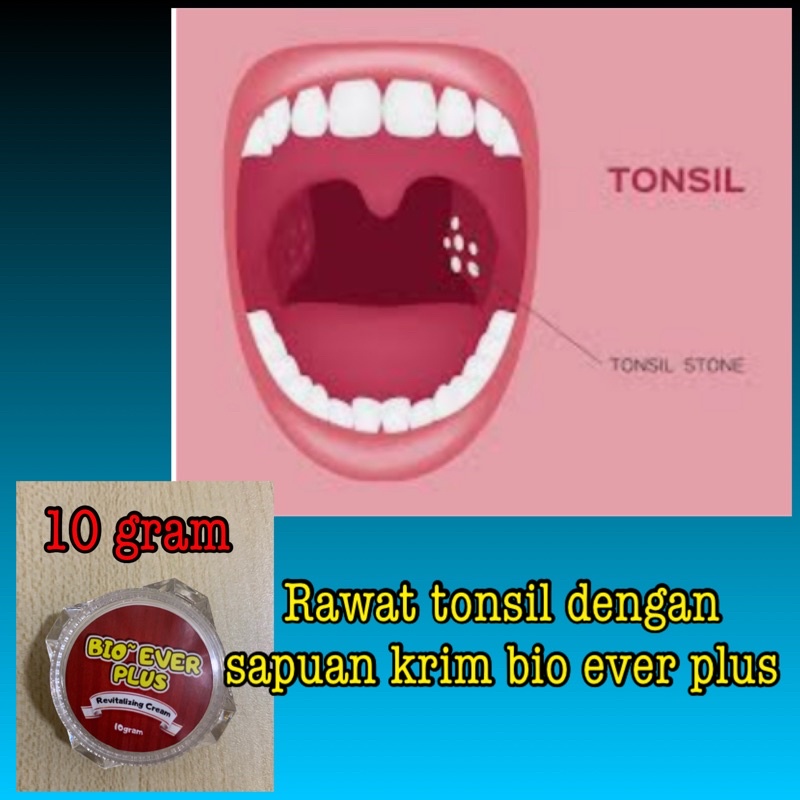 Alami Tonsil Sapu Krim Sapu 10gram Trial Shopee Malaysia