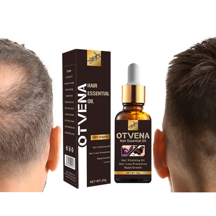 OTVENA 7 days Hair Growth Essential Oil 20ML Anti hair loss Beard Regrowth  Baldness Scalp treatment hair Care For Men & Women | Shopee Malaysia