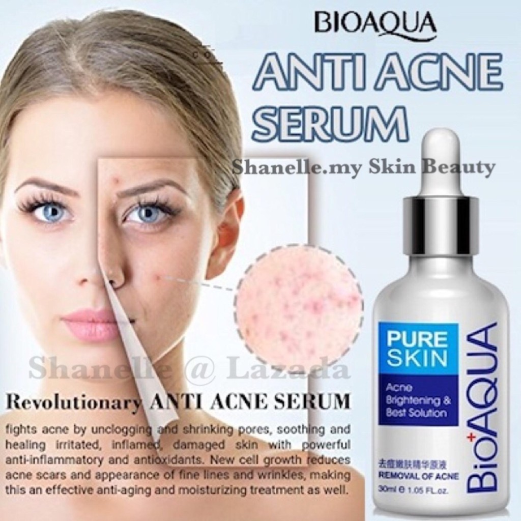 Acne Removal Bioaqua Pure Skin Brightening Best Solution Serum Shopee Malaysia