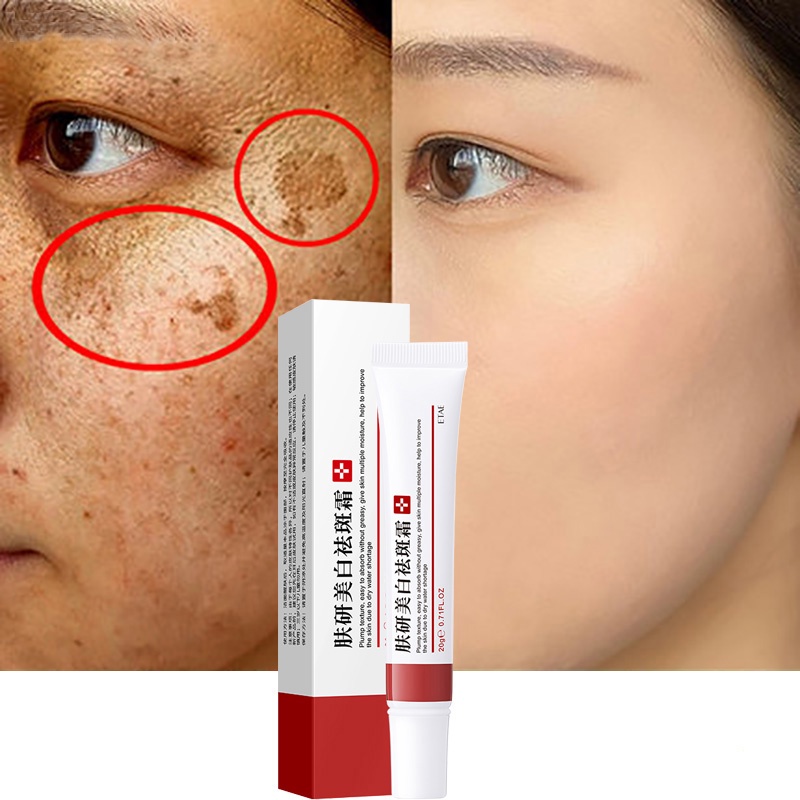 Whitening Freckle Cream Remove Melasma Cream Remove Dark Spots Melanin Melasma Remover Brighten Skin Anti-Aging Skin Lightening