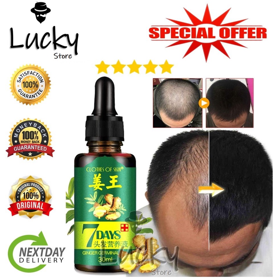 Lucky Store [100Original] Ginger Germinal Oil Hair Tonic Growth By