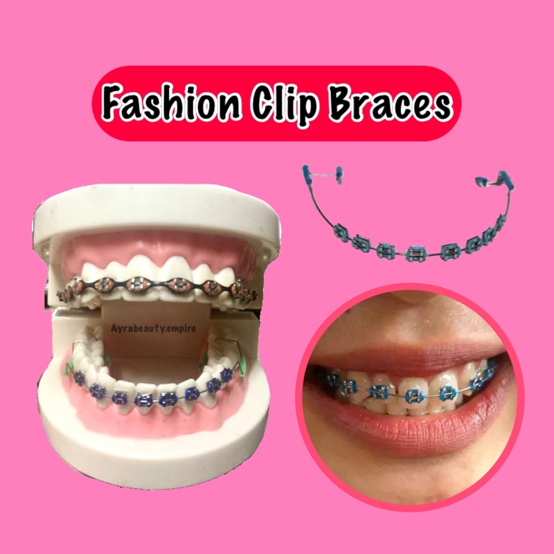 Buy Ready Stock Fake Braces Clip Fashion Tiktok Viral Klip Braces Selfie Ootd Behel Pendakap Gigi Teeth Whitening Seetracker Malaysia