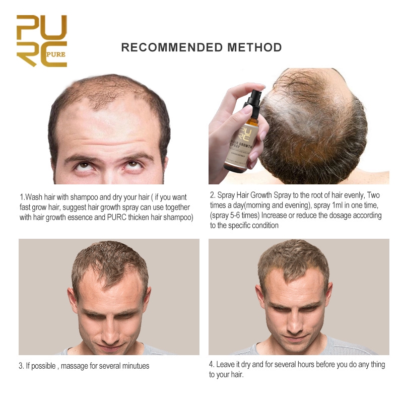ღღ New 30ml Purc Hair Growth Spray Extract Prevent Hair Loss