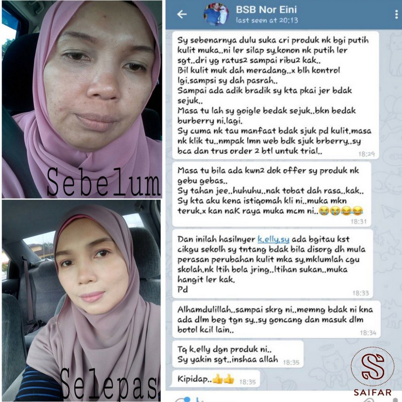 Bedak Sejuk Bearberry 30ml Pek Percubaan Trial Pek Untuk Merawat Jerawat Jeragat Memutihkan Kulit Shopee Malaysia