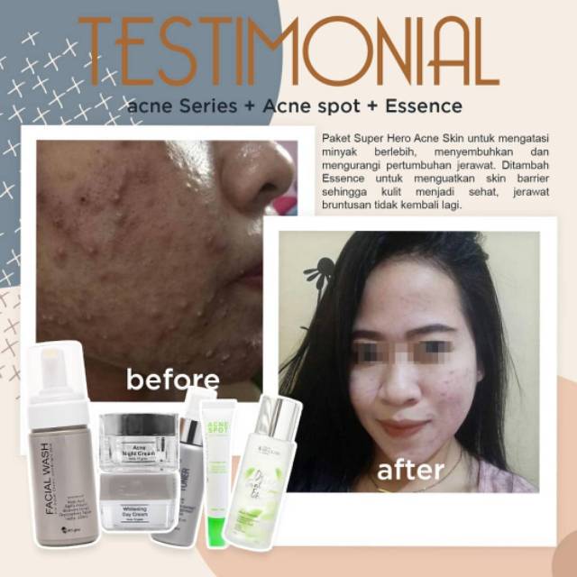 essence ms glow acne