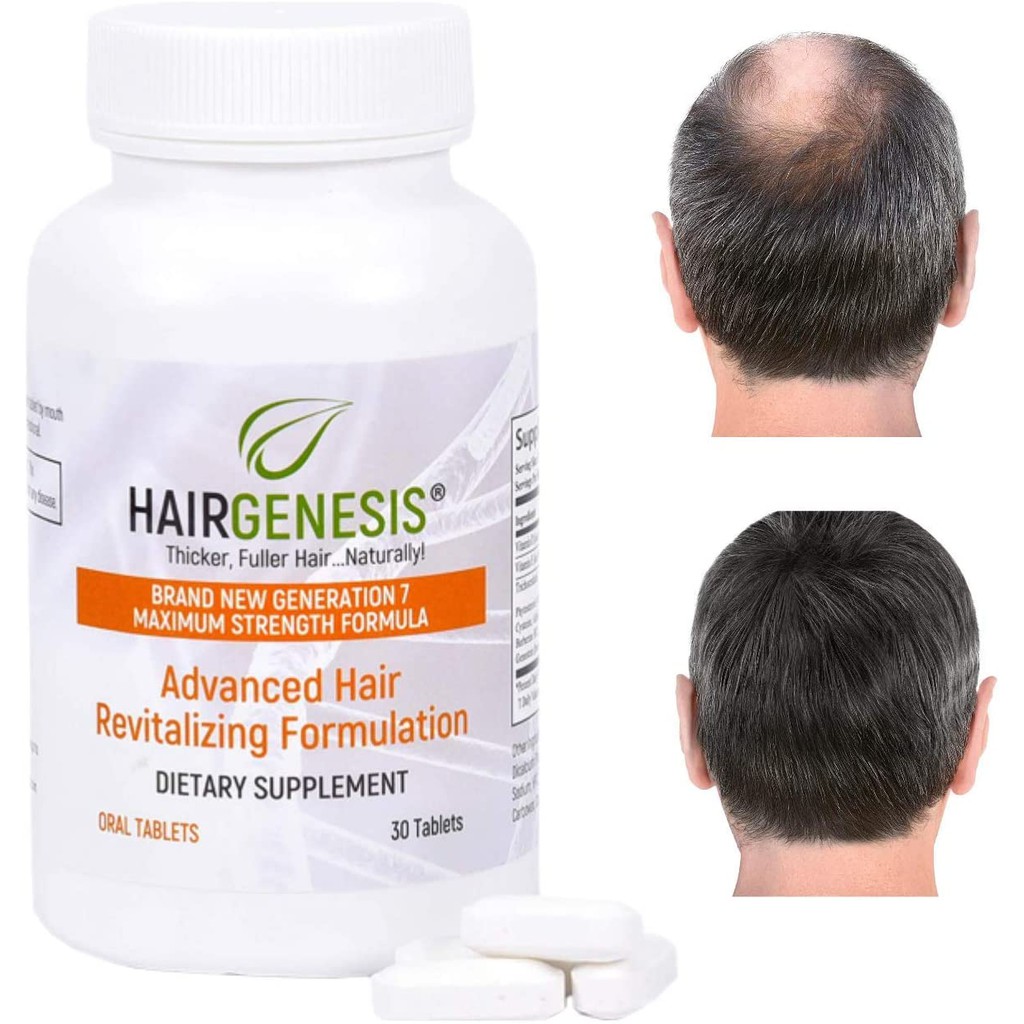 HairGenesis Advanced Formula Hair Growth Tablets (30 Count) - Hair Growth  Pills & Anti Hair Loss Supplement for Regrowth of Thinning & Fine Hair in  Men & Women - 100% Safe &
