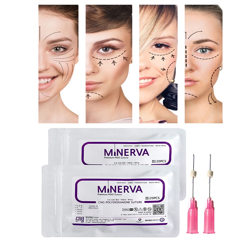 Minerva thread lift pdo pcl plla Mono screw spring Cog big small V molding cog eye nose thread 19G 18G 100mm and 60mm for cheek nose face and body