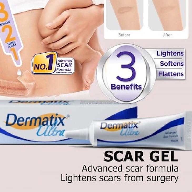 Dermatix Ultra Advanced Scar Treatment Cream 15 Grams Of Scars Shopee