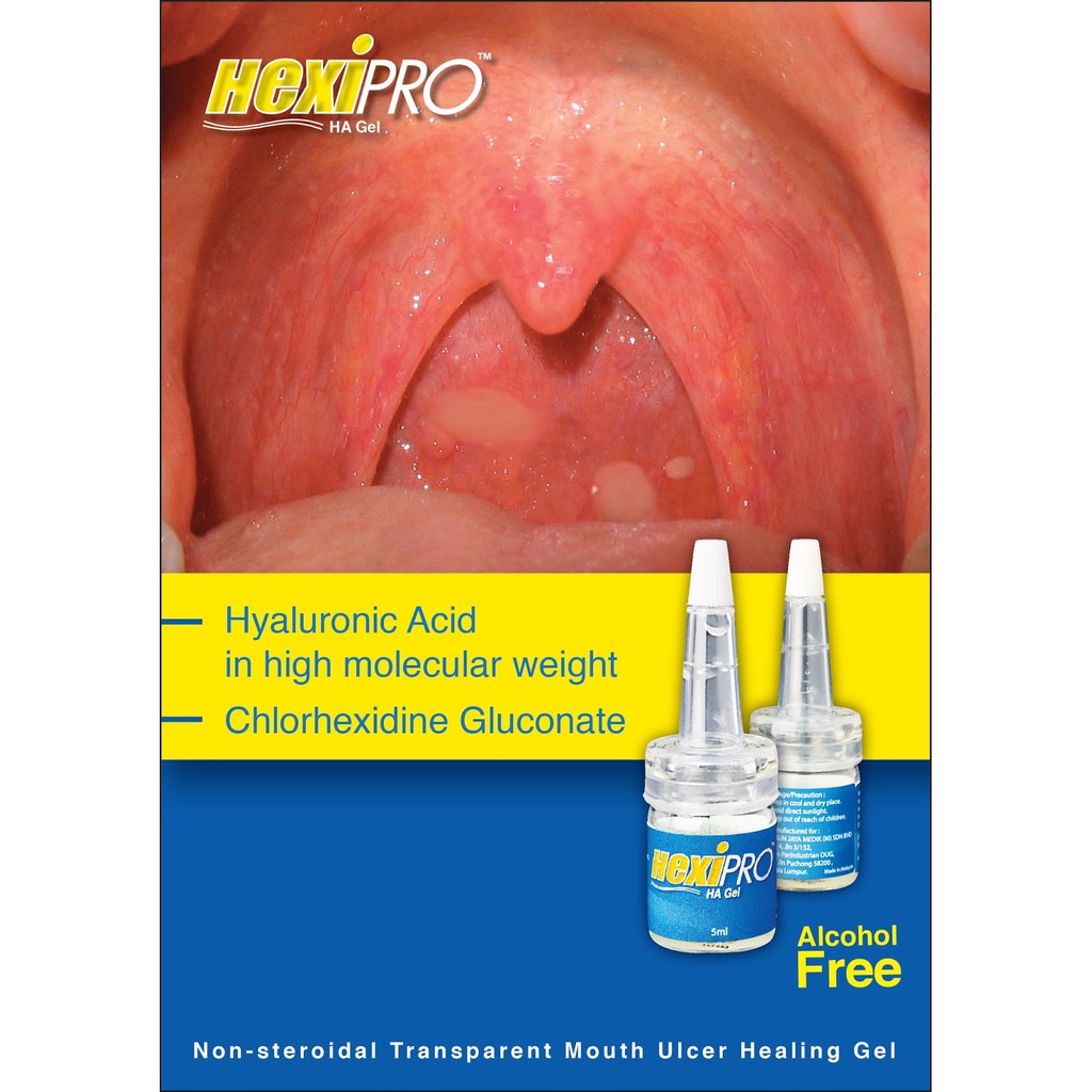 HexiPRO HA Gel Hyaluronic acid for ulcer 5ml (EXP 7/2022) Shopee