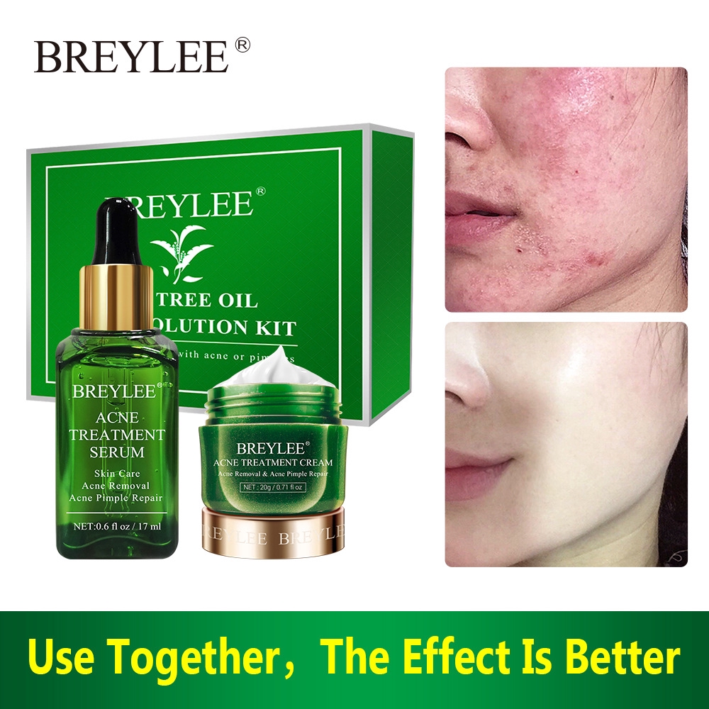 acne cream with tea tree oil