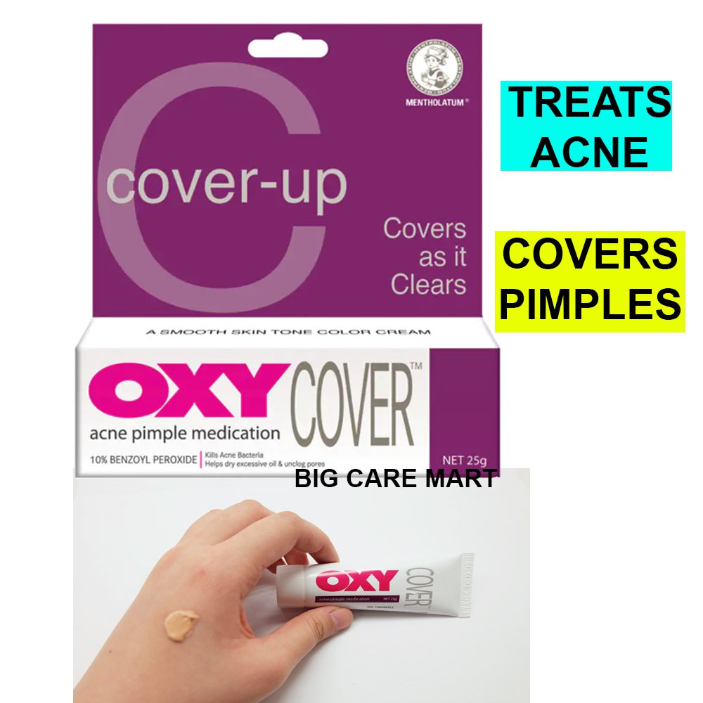 acne cream oxy