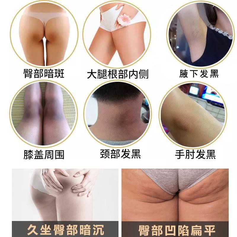 去黑 去除黑色素 黑脖子腋窝手臂大腿内侧棘皮身体美白去黑色素沉淀 Shopee Malaysia