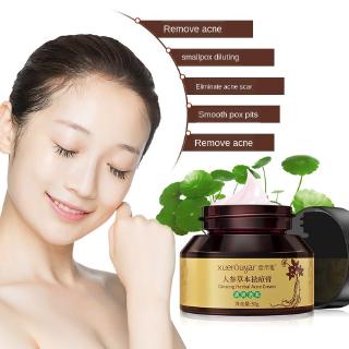 Xue Rou Ya Ginseng Herbal Acne Cream Fade Acne Marks ...