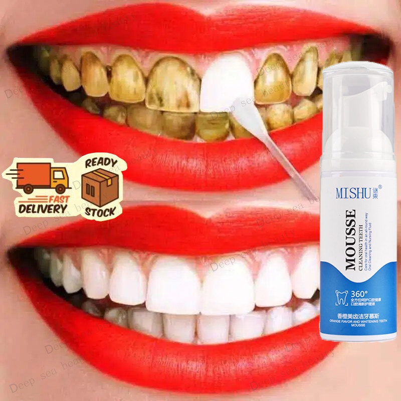 Teeth Cleansing Whitening Mousse Removes Stains Oral Hygiene Mousse ...