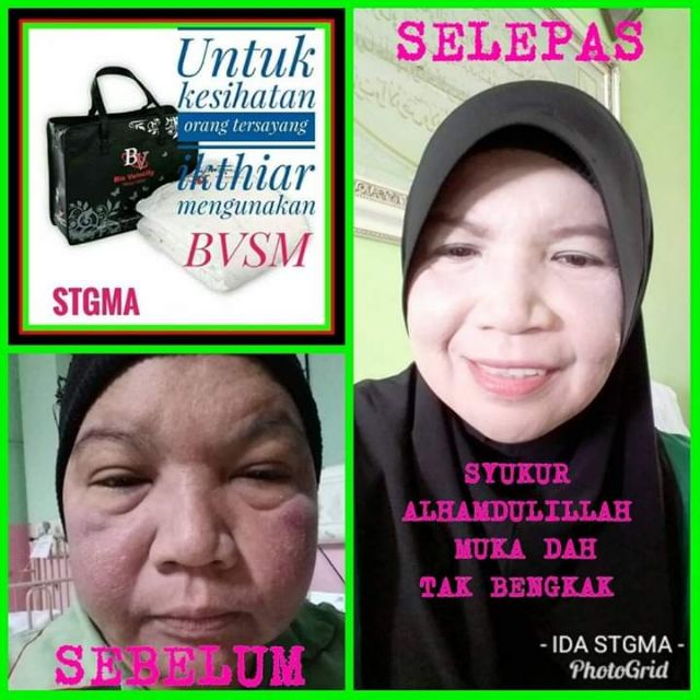 Tips Penjagaan Buah Pinggang Norsharina Abu Bakar