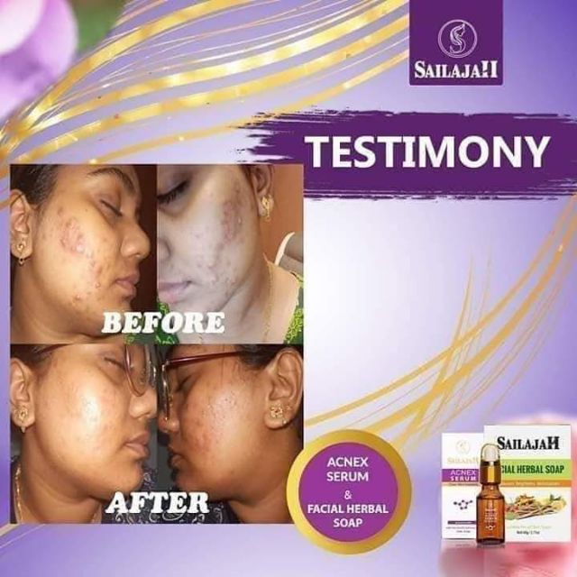 sailajah acne serum