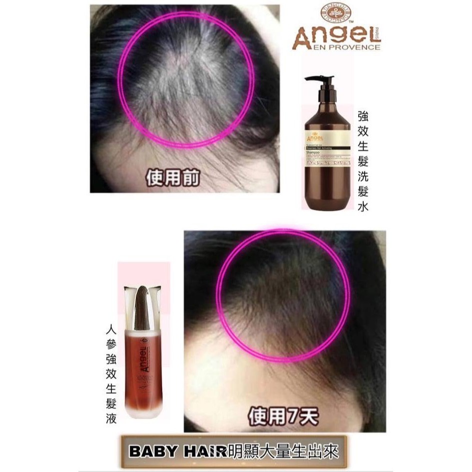 熟女の鼻フック 