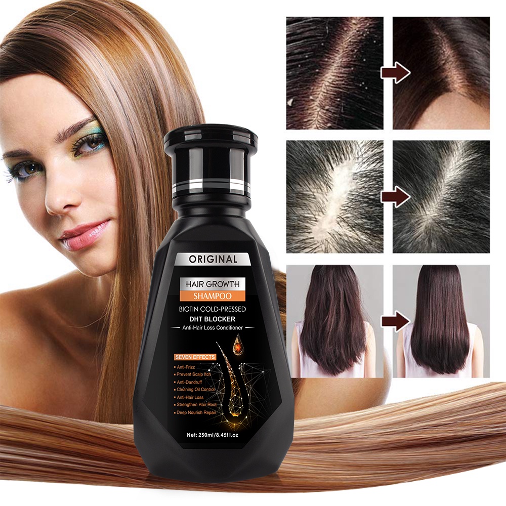 Hair Growth Serum, Repair Damaged Hair Follicles, Anti Hair Loss, Anti  Split, Deeply Nourish, Anti-dandruff, Anti-itch, Smooth | Hair Growth  Serum, Repair Damaged Hair Follicles, Anti Hair Loss, Anti Split, Deeply  Nourish,