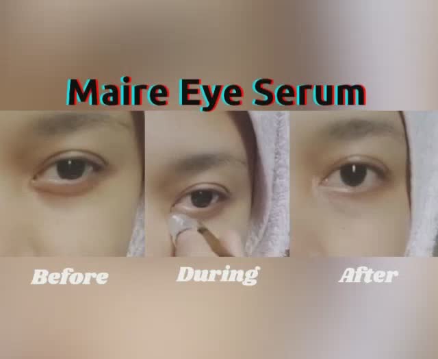 Review eye serum untuk mata panda