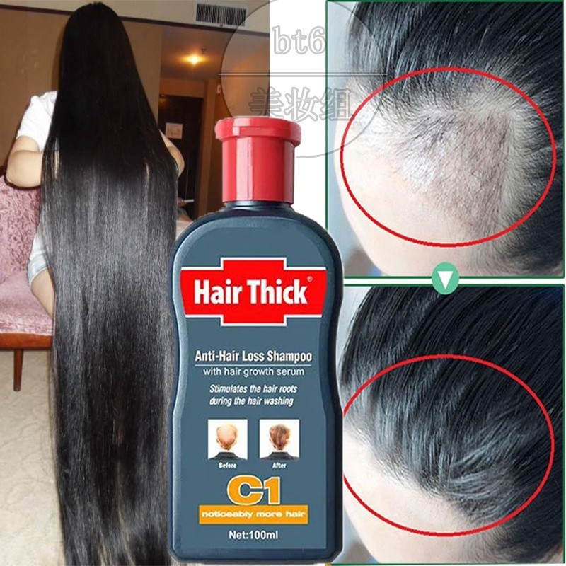 100ml Natural Hair Growth Essence Hair Loss Treatment Hair Growth