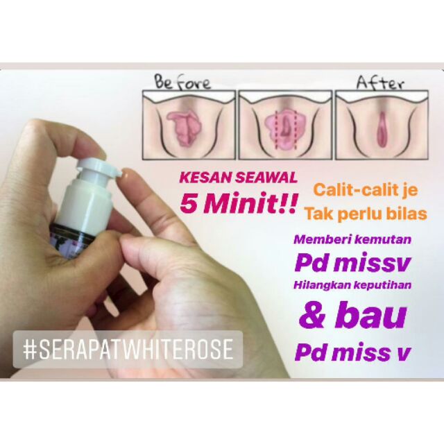 Ready Stock Minyak Ketatkan Miss V Hilangkan Kegatalan Dan Keputihan