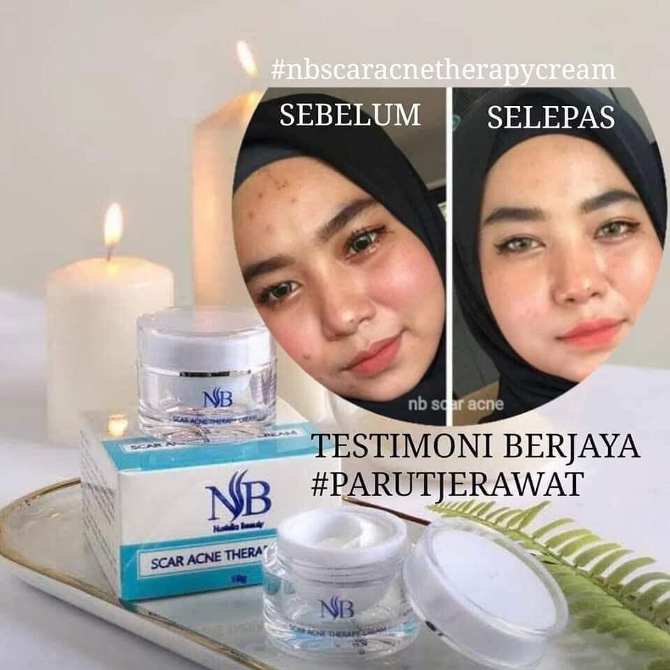 nb acne scar cream