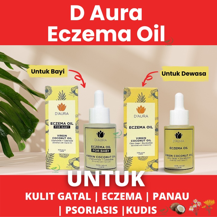 Ubat Gatal Kulit Minyak Kelapa Dara Vco D Aura Utk Psoriasis Eczema