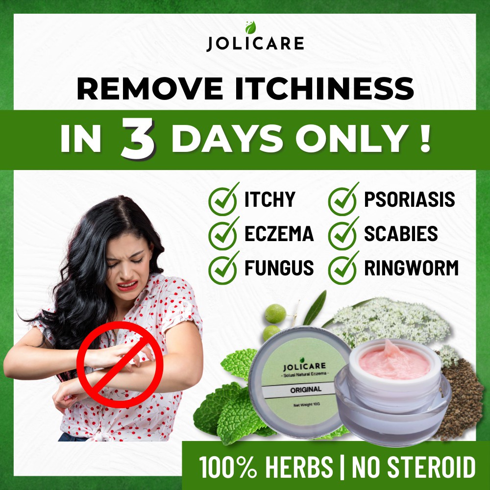 Hot Stock Jolicare Original Eczema Cream Krim Gatal Kulit Ubat Panau Ubat Kurap Ubat Gatal Psoriasis Cream Antifungal Shopee Malaysia