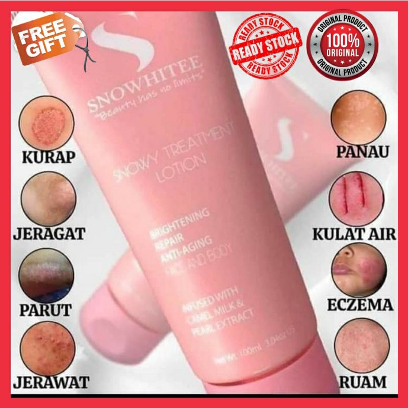 LOSYEN MERAWAT EKZEMA, RUAM & SAKIT KULIT SNOWY TREATMENT LOTION(losyen untuk ekzema+mengandungi susu unta,melembapkan)