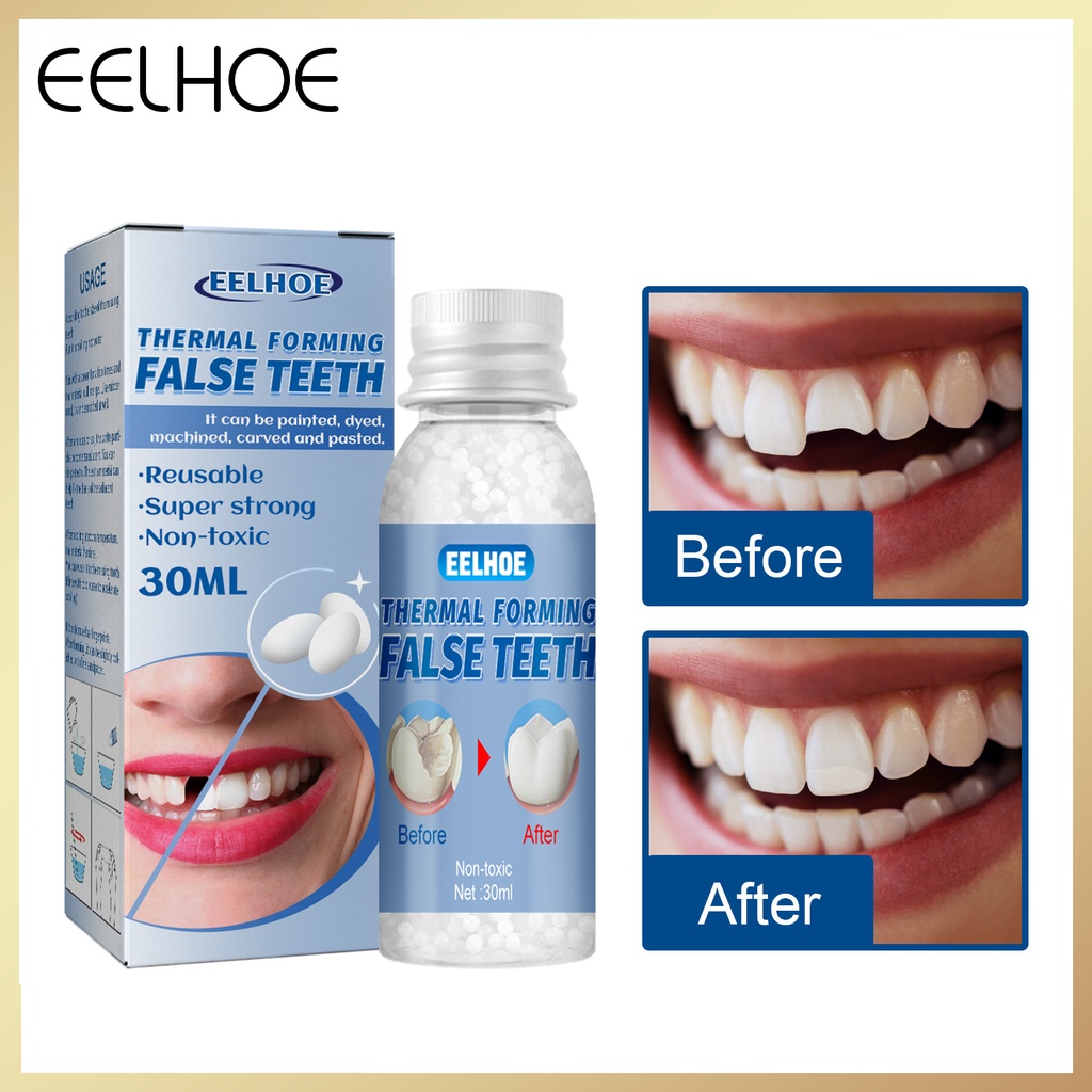 eelhoe-30g-dental-restoration-temporary-tooth-repair-kit-glue-denture
