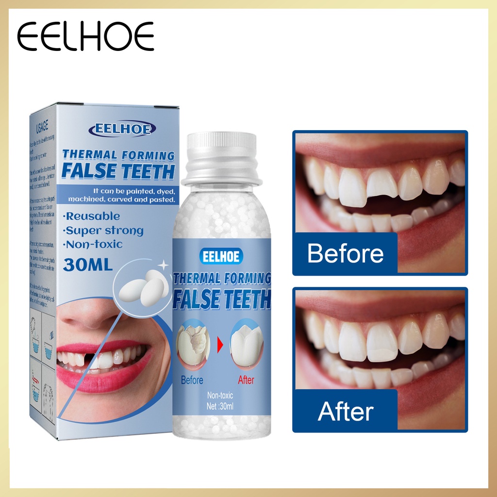 Eelhoe (30g )Dental Restoration Temporary Tooth repair kit glue denture