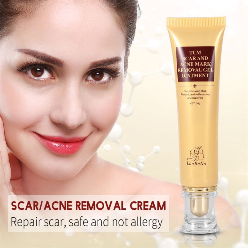 Lanbena Acne Scar Removal Cream | Shopee Malaysia