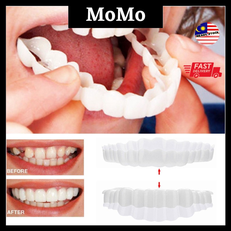 Snap On Smile gigi palsu 1set atas bawah Instant Charming Smile Removable Veneers RB-Dentistry Perfect Smile Comfort Fit