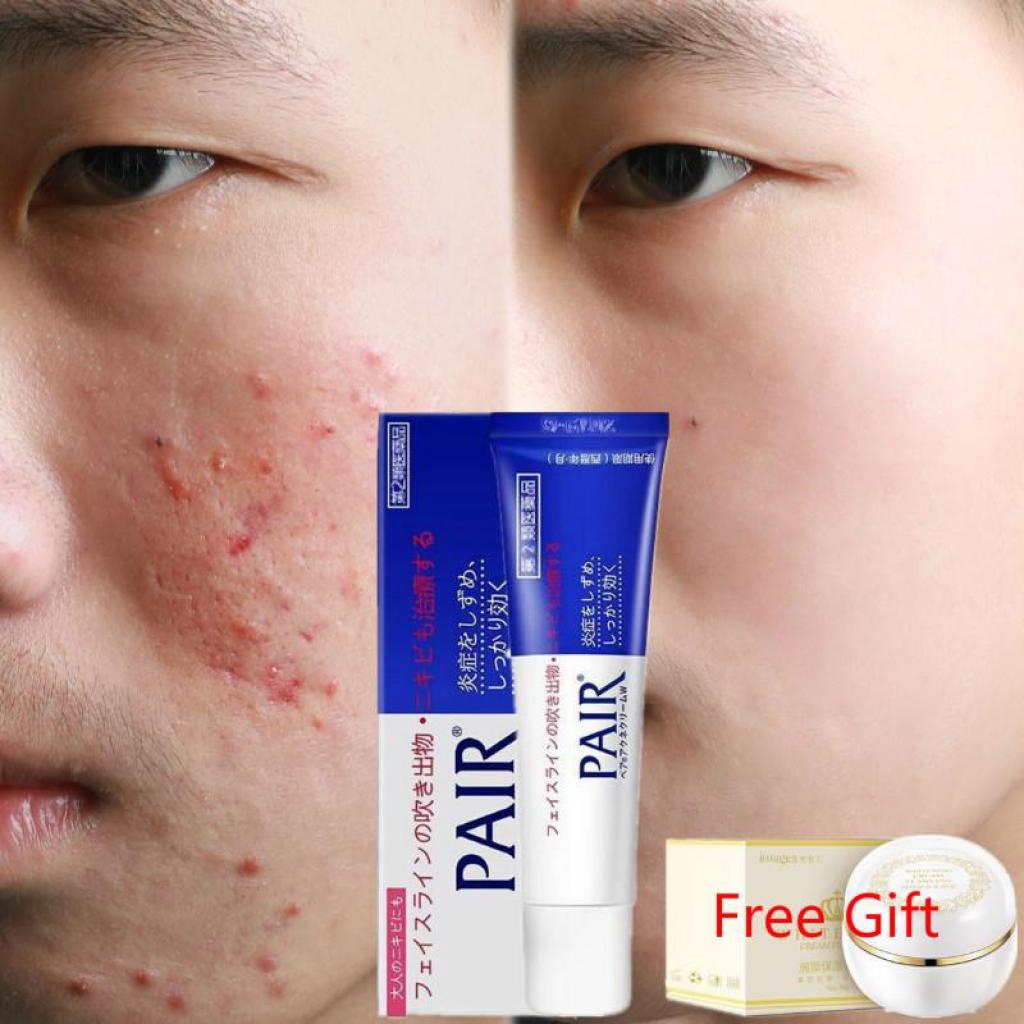 [LION PAIR] Japan Acne Treatment Cream Scar Removal Skin Care Powerful Effect 24gLION PAIR