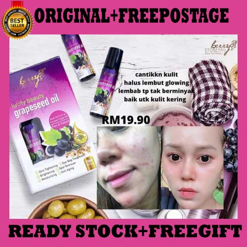 Grapeseed oil ubat jerawat roll Minyak biji anggur Shopee Malaysia