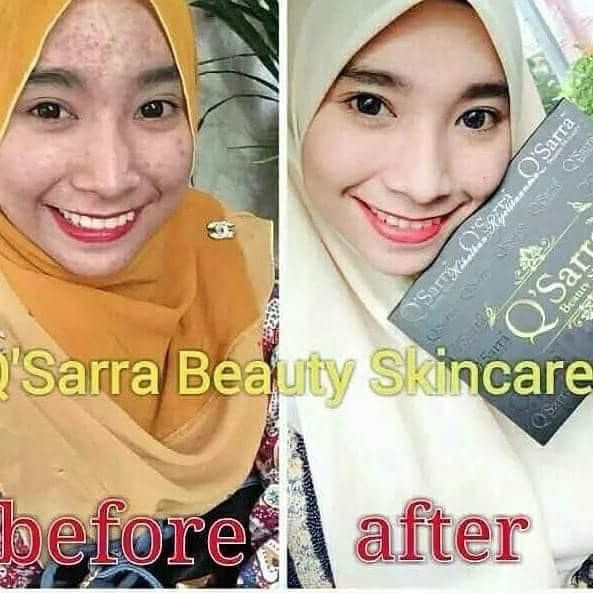 Buy [READY STOCK] Set Skincare Exclusive Qsarra Beauty (140g) 3in1 