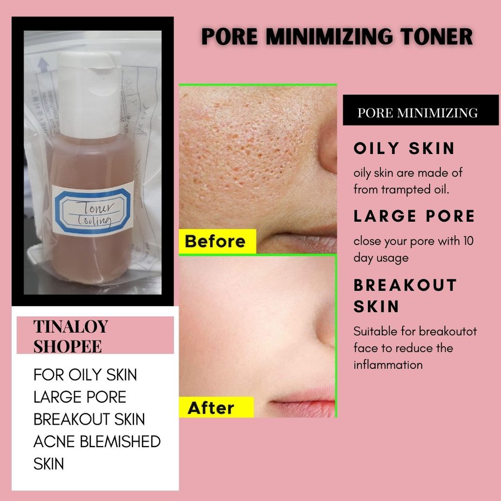 Toner Pelembab Pori Pore Terbuka Breakout Face Acne Jerawat Toner Close Pore Oily Skin Toner Shopee Malaysia