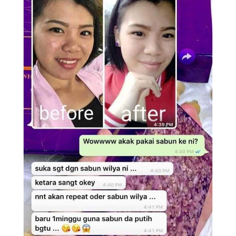 Wilya Whitening Soap Sabun Wilya Shopee Malaysia