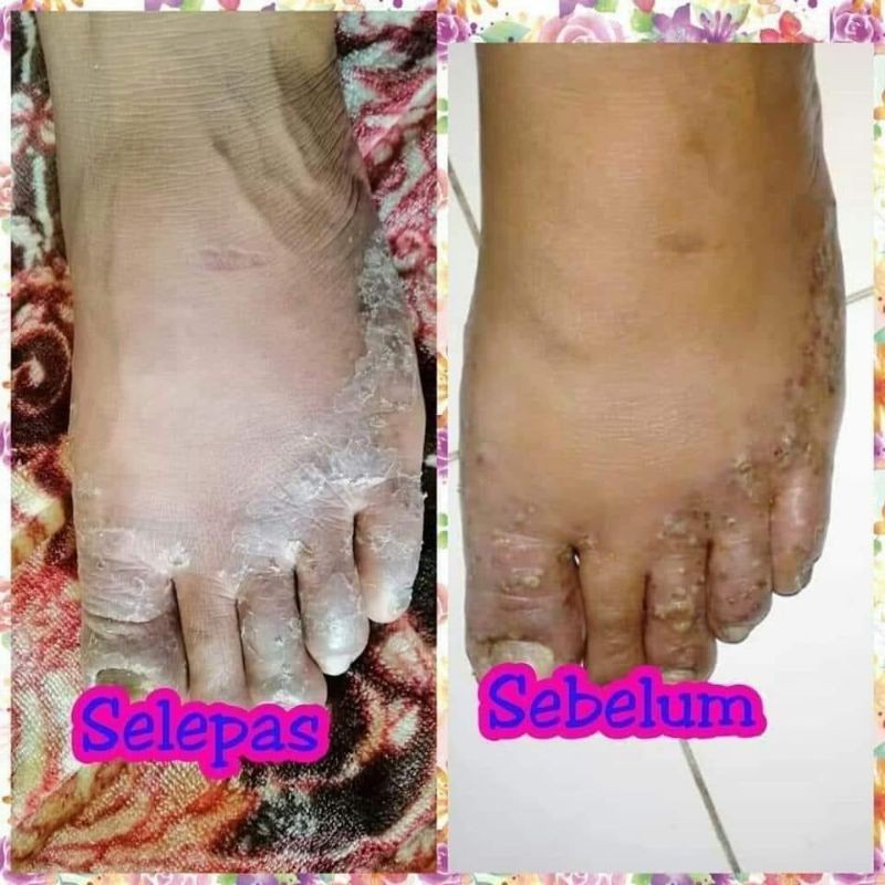 LOTION SUSU UNTA TREATMNT