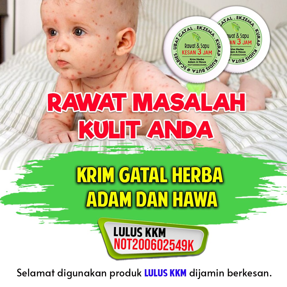 Eczema Treatment Anti Bacterial Skin Fungus Cream Ubat Hilang Gatal Kurap Psoriasis Panau Ruam Salep Kulit Ori