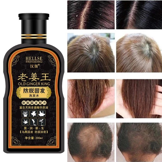 Ginger Juice Hair Growth Shampoo Prevent hair loss Strong Hair Roots hair  growth Shampoo 200ml, Dense Hair Shampoo | Shopee Malaysia