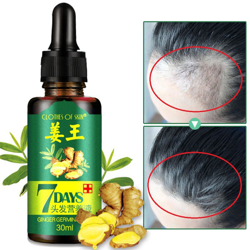Exo ღ Hair Loss Treatment Ginger Hair Growth Serum Hair Care