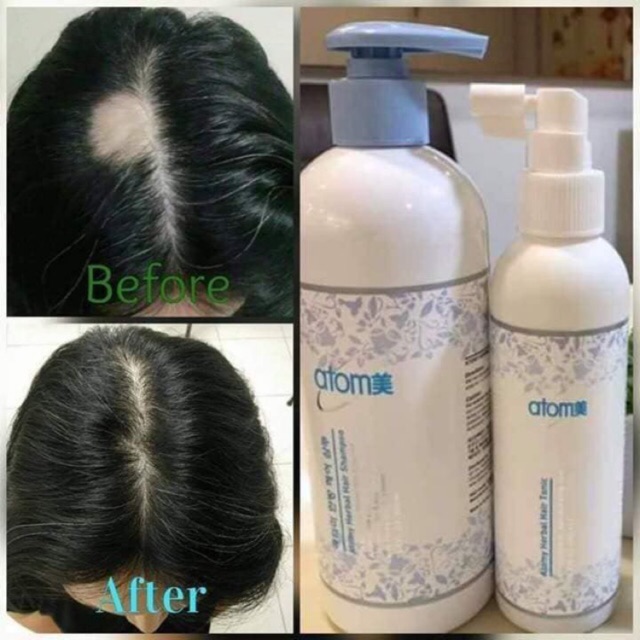 Atomy Hair Tonic 200ml free Shipping ORIGINAL Shopee Malaysia