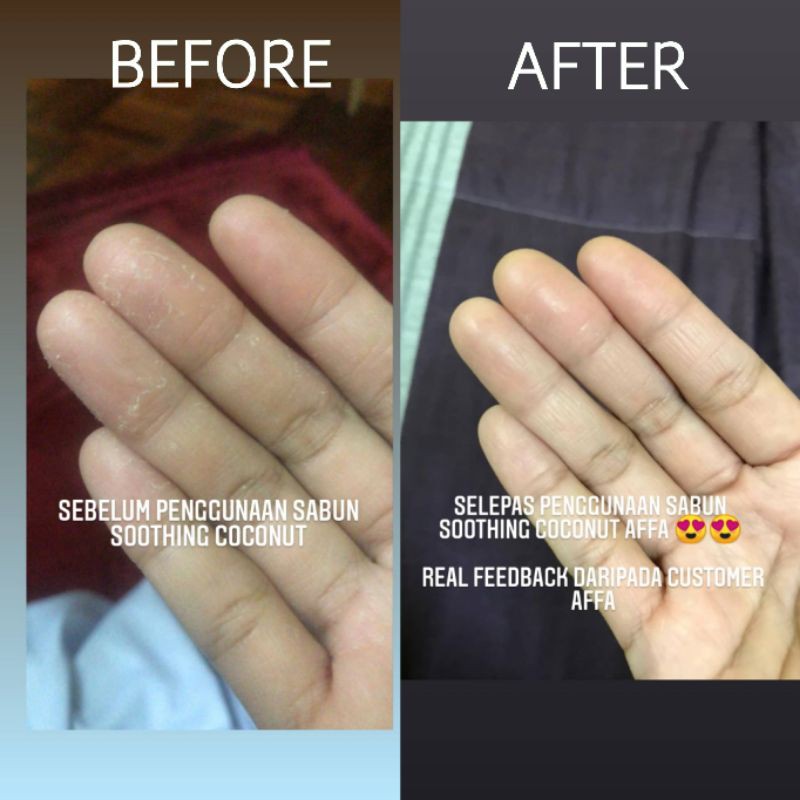 Buy Scrub Badan Rawat Gatal Badan Jerawat Badan Sinus Problem Resdung Body Acne Product Muslim Seetracker Malaysia